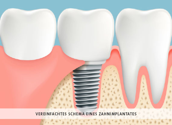 Bild Home Implantologie, Praxis für Zahnheilkunde